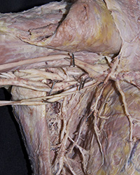 Axilla Nerves