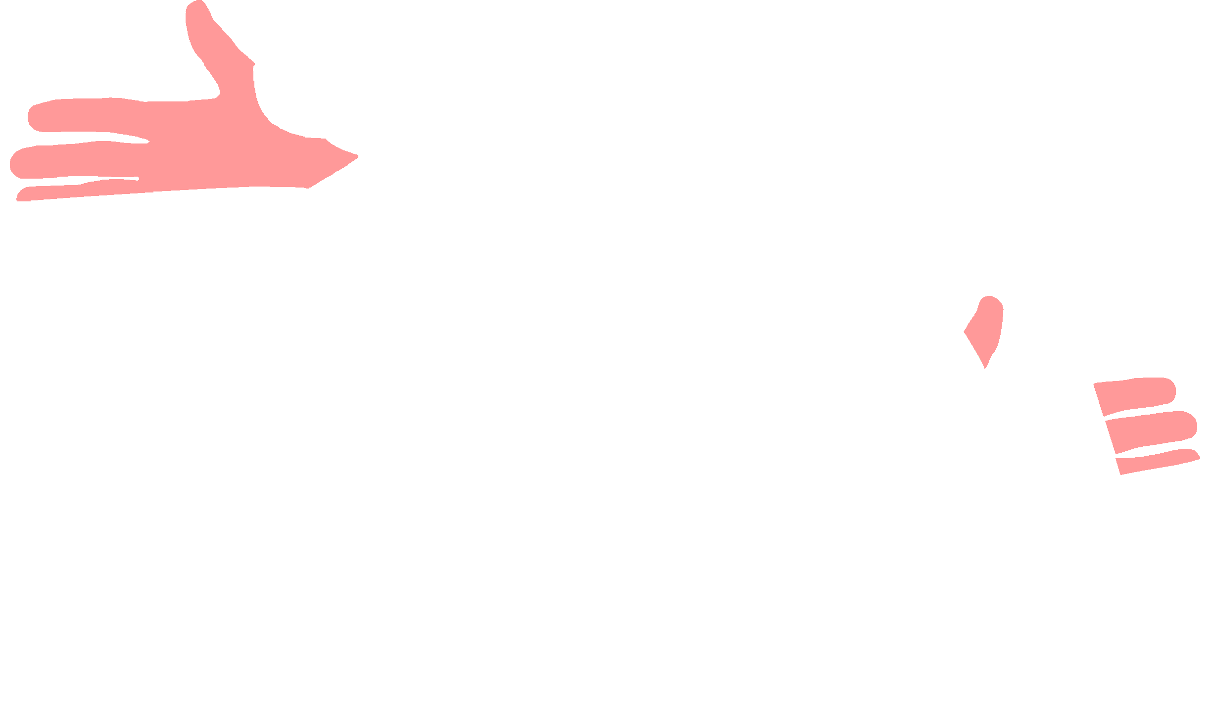 Median nerve (palmar and digital branches)
