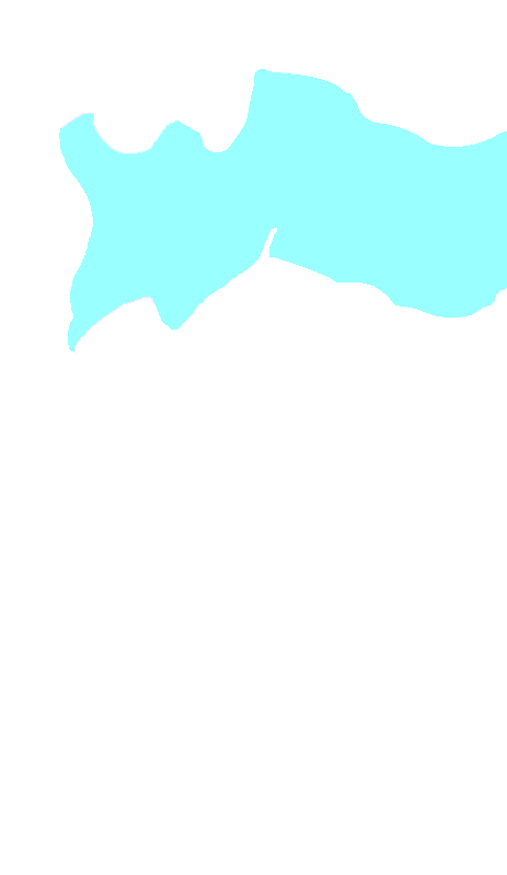 C3 Vertebra