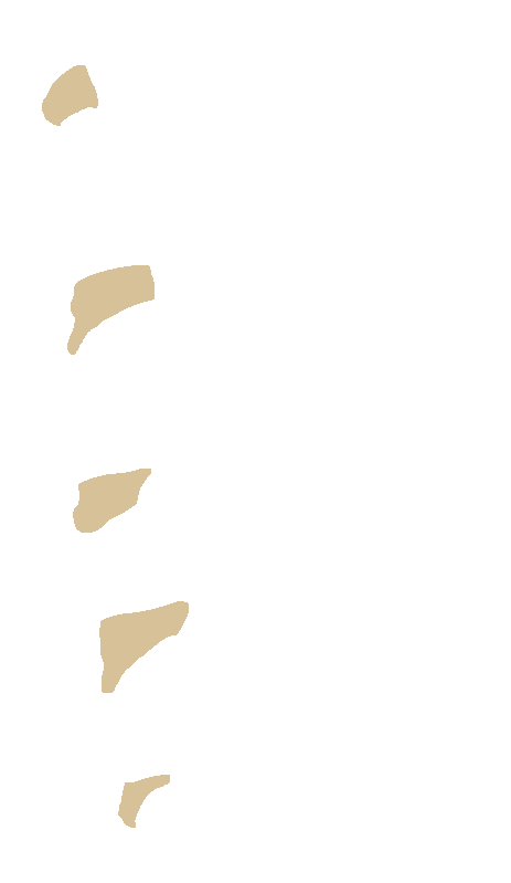 Inferior Articular Processes