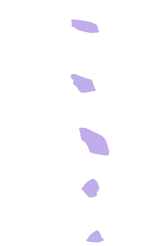 Uncinate Processes