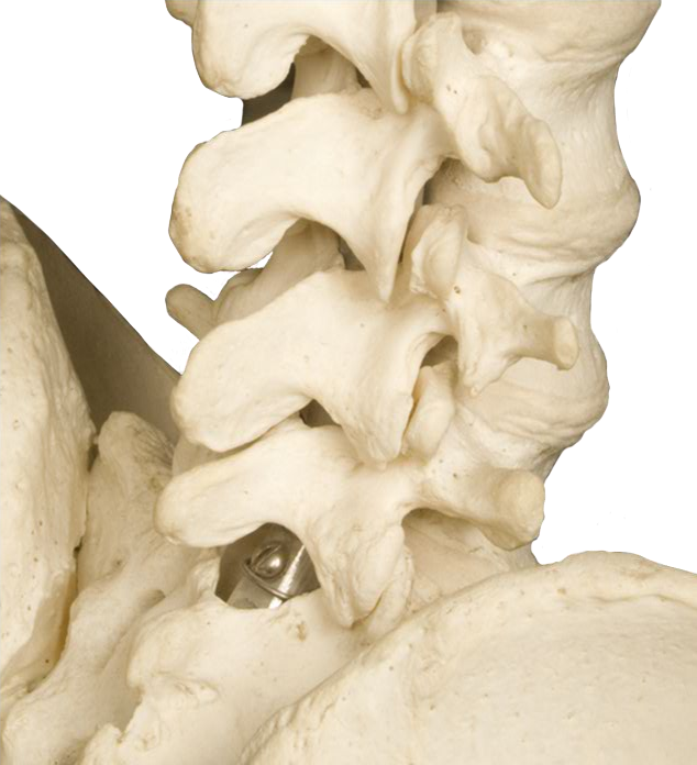 Lumbar Spine