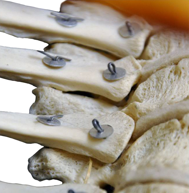 Anterior Thoracic Spine