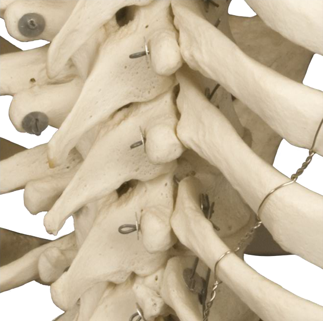 Posterior Lateral Thoracic Spine