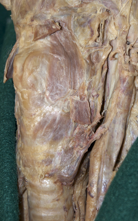 Thyrohyoid Muscle
