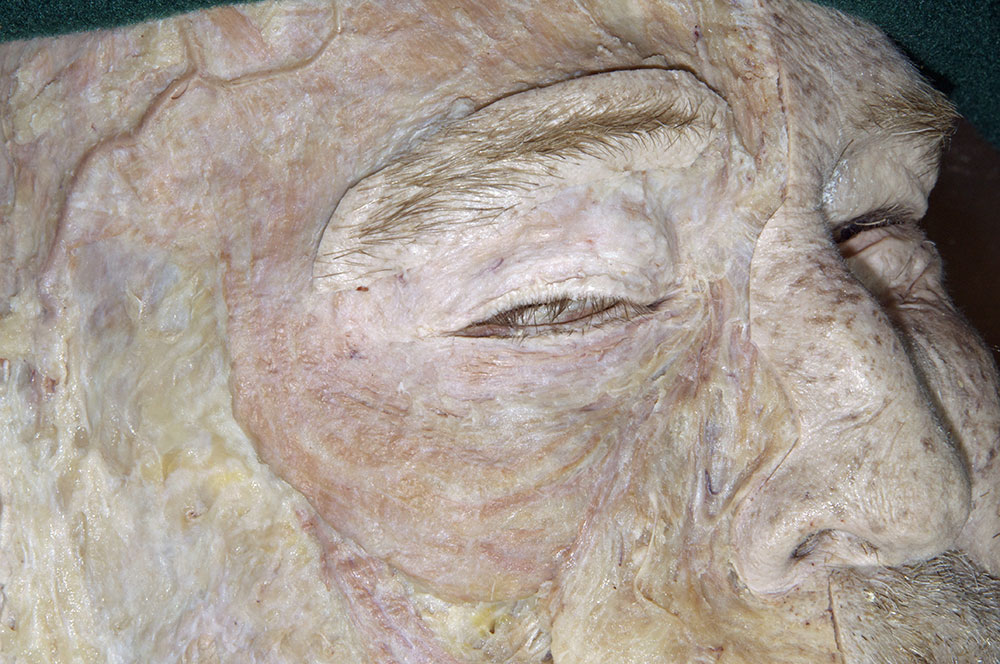 Orbicularis Oculi Muscle