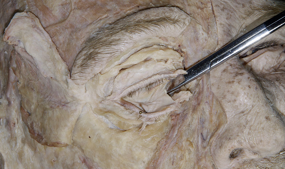 Conjunctiva
