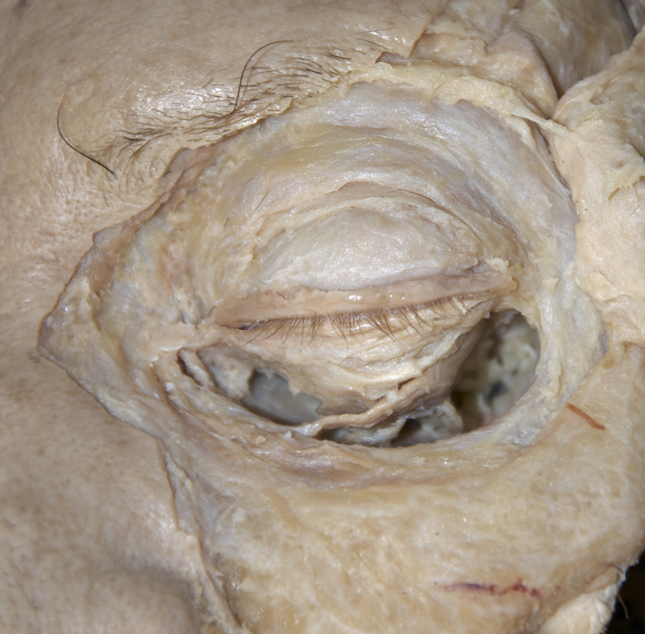 Lacrimal Sac