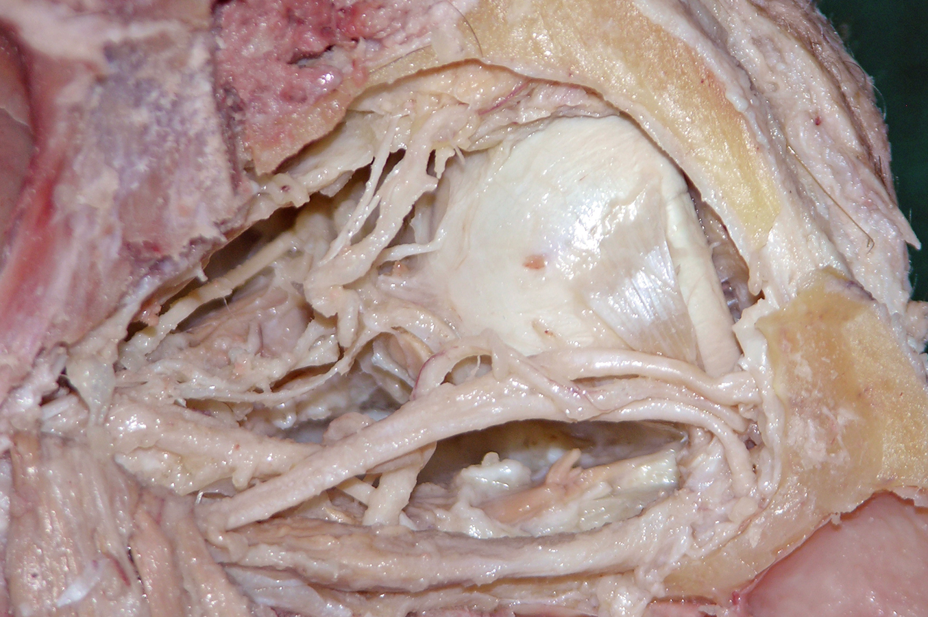 Left Trochlea (medial to the bottom)