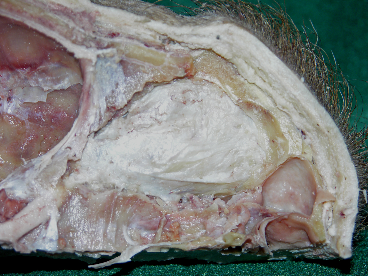 Left Orbital Periosteum