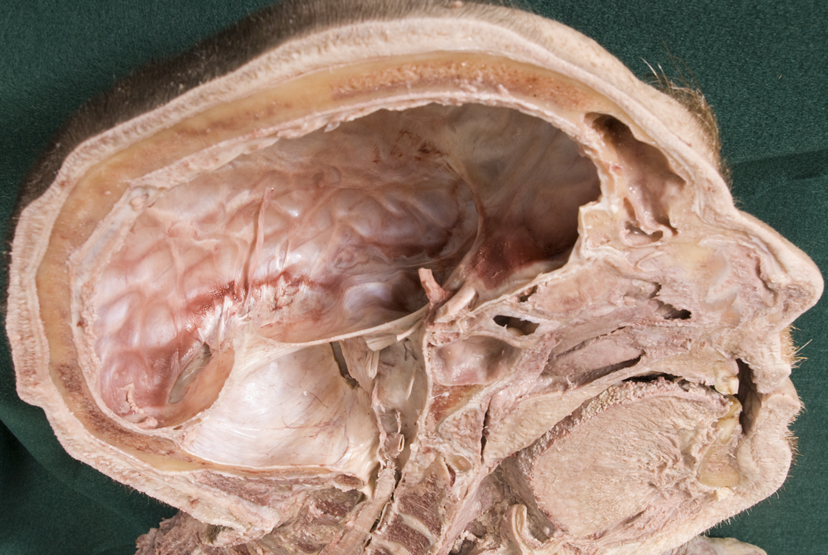 Tentorium cerebelli