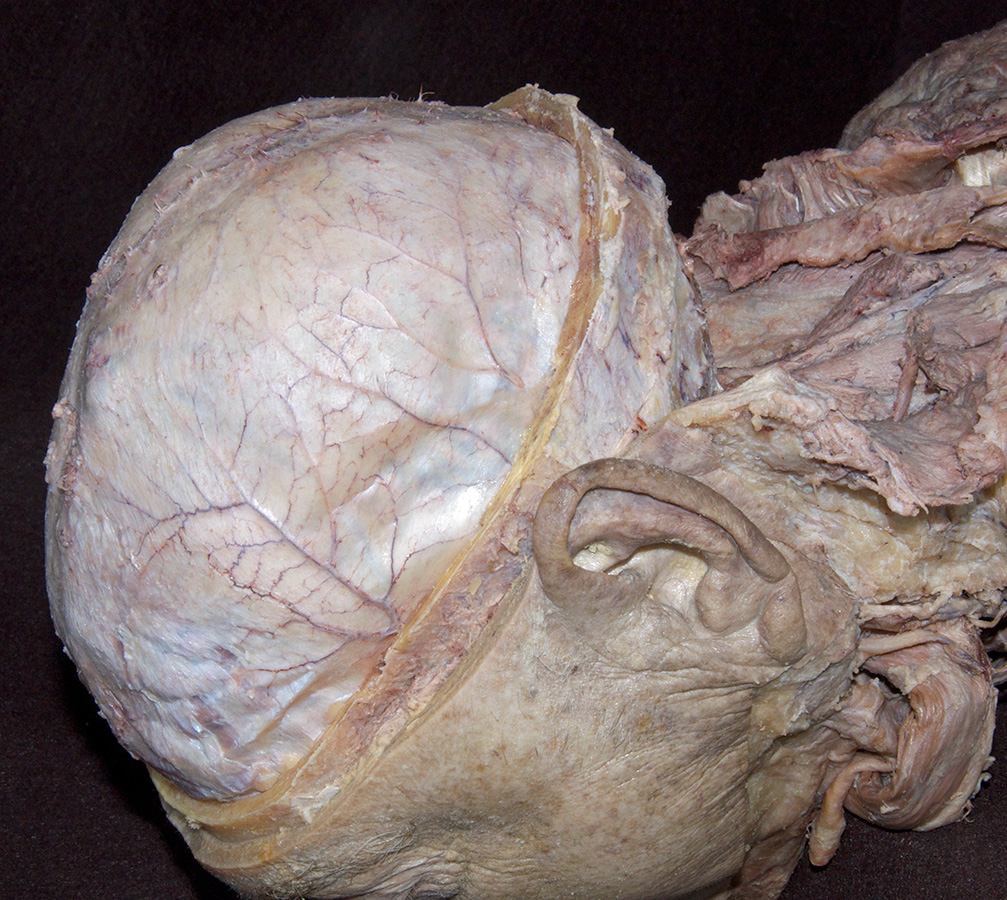 Cranial Dura Mater