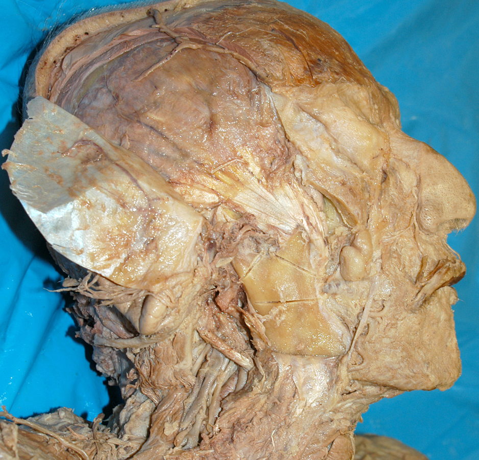 Mandible (saw lines)