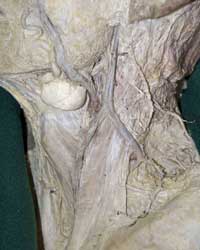 Superficial Cervical Veins