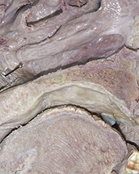 Palatal Muscles