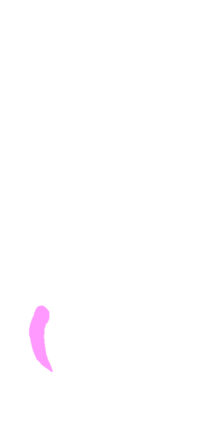 Lateral Epicondyle