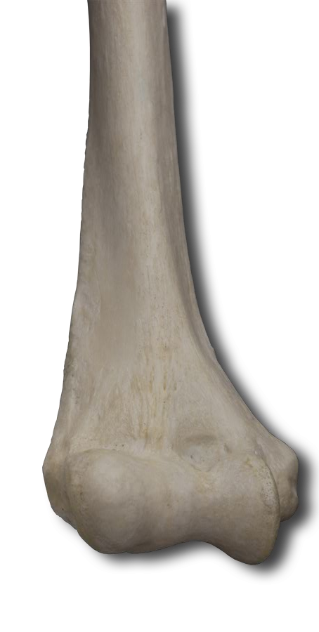 Anterior Distal Humerus