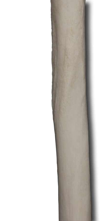Posterior Shaft of the Humerus