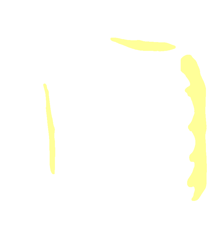 Pectoralis Major