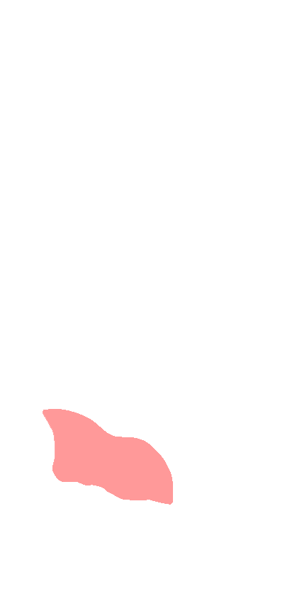 Carpal Articular Surface