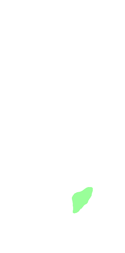 Styloid Process