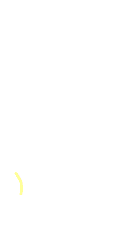 Ulnar Notch