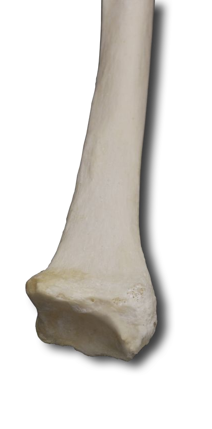 Anterior Distal Radius