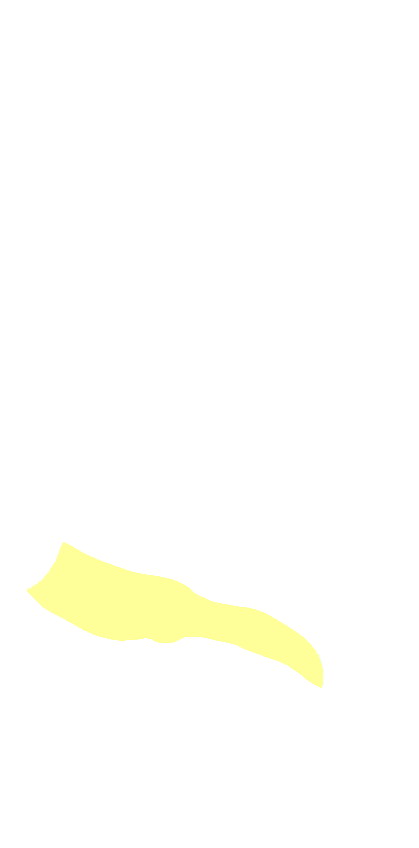 Carpal Articular Surface