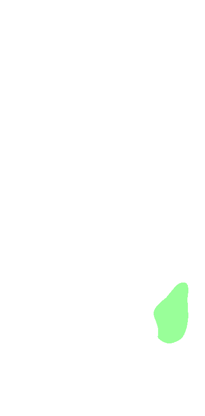 Styloid Process