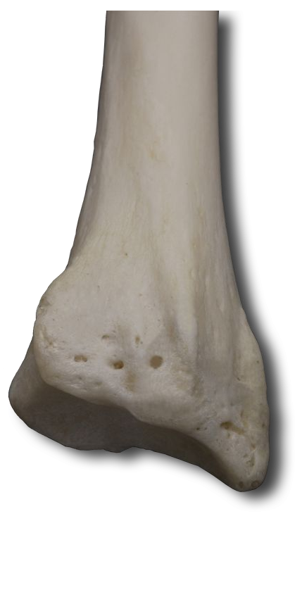 Posterior Distal Radius