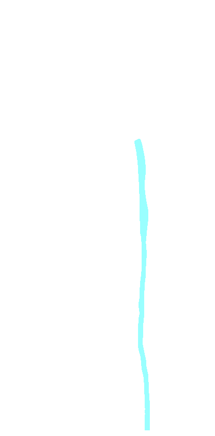 Interosseous Border