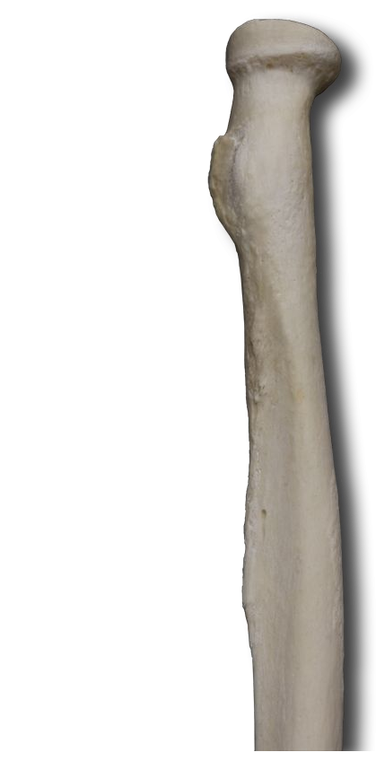 Anterior Proximal Radius