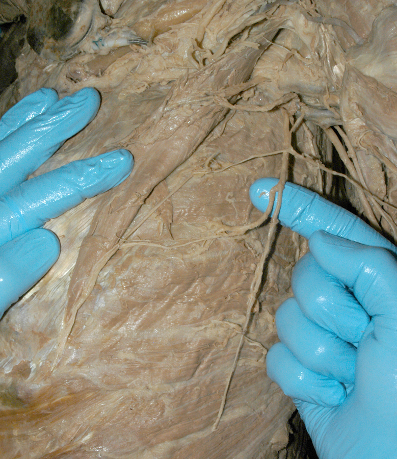 Lateral Thoracic Artery