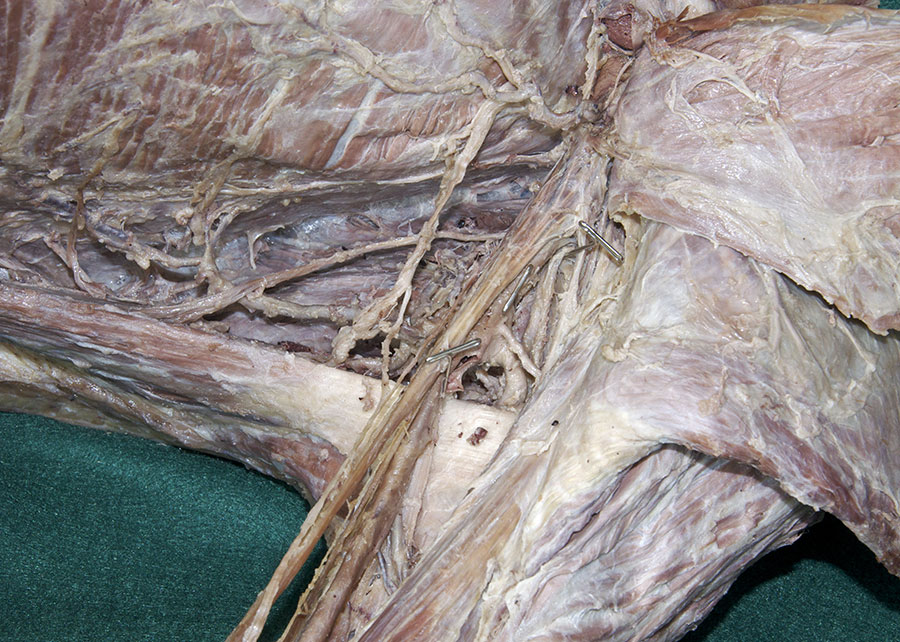 Axillary Nerve