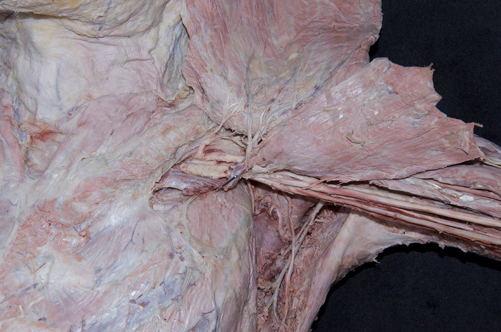 Axillary Artery