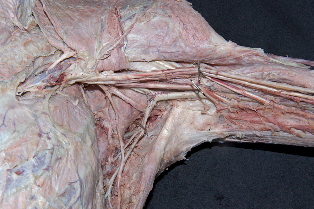 Subscapular Artery