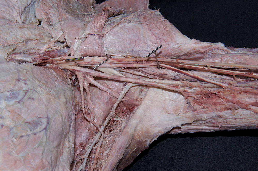 Posterior Cord