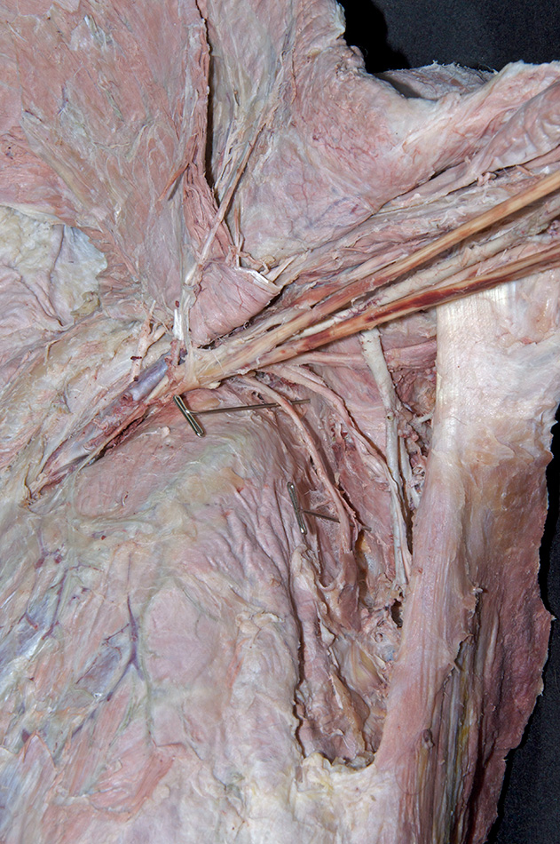 Long Thoracic Nerve