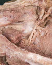 Supraspinous Fossa Ligaments