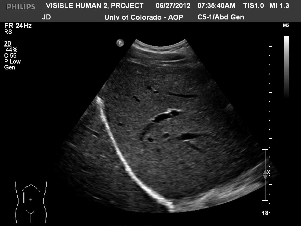 Ultrasound Radiology Library