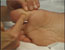 tendon