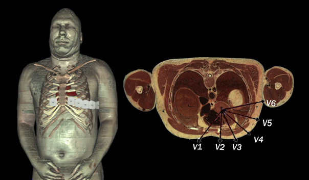 12 Lead EKG Placement