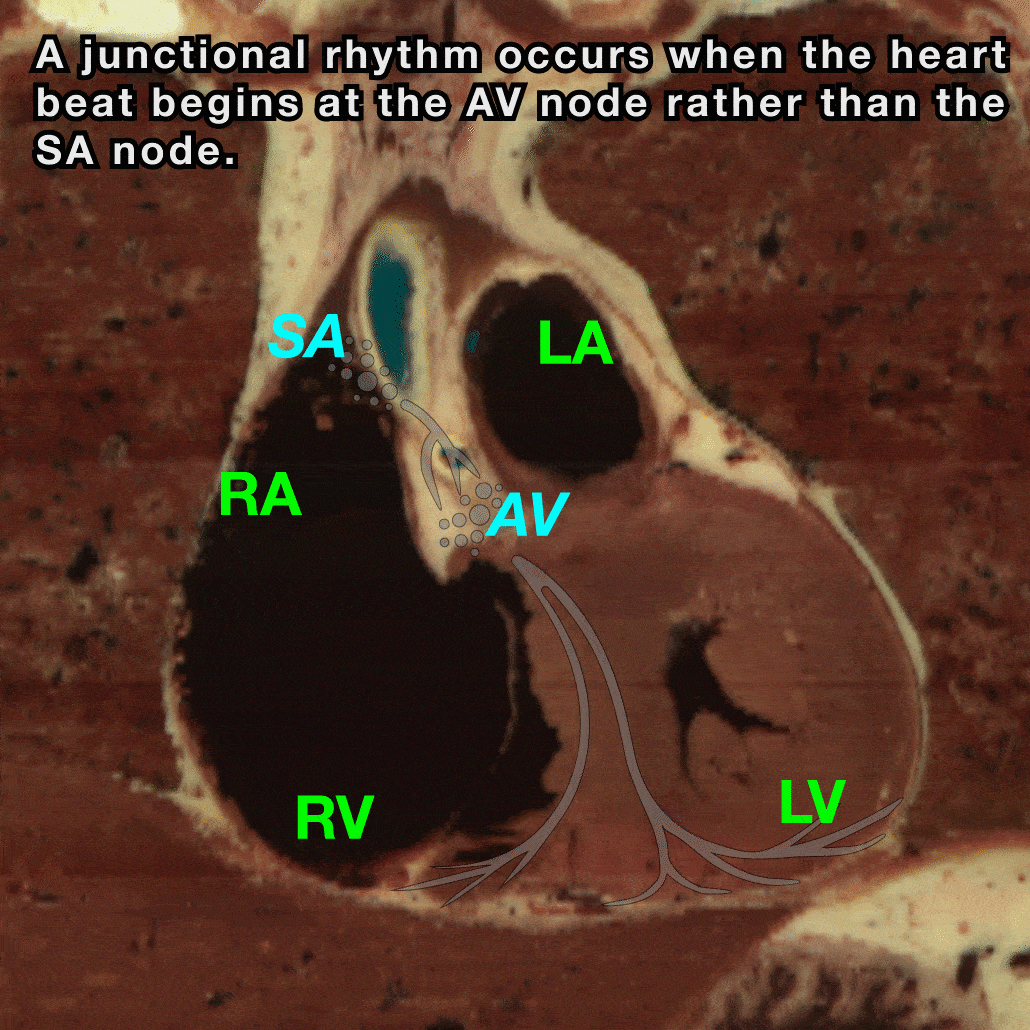 Junctional