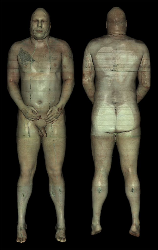 Dermatomes