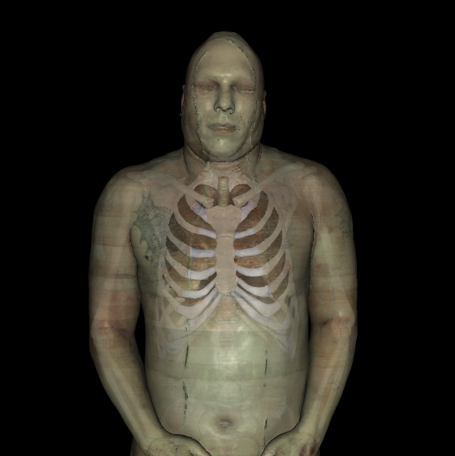 Anterior