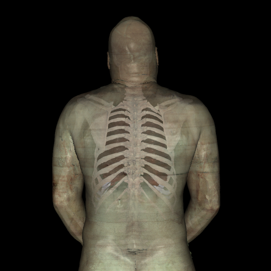 Posterior