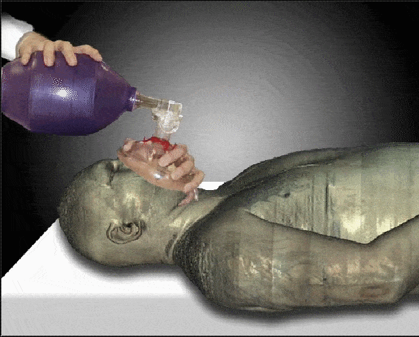 Bag Valve Mask